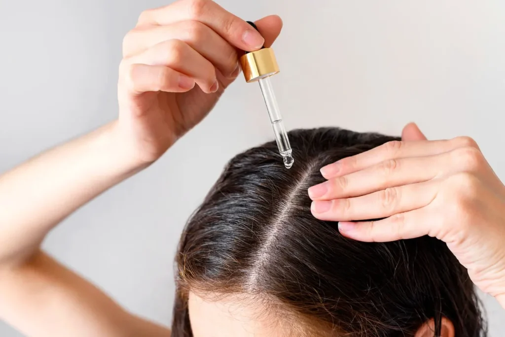 Effective Hair Growth Treatments for Thinning Hair Top Solutions to Try